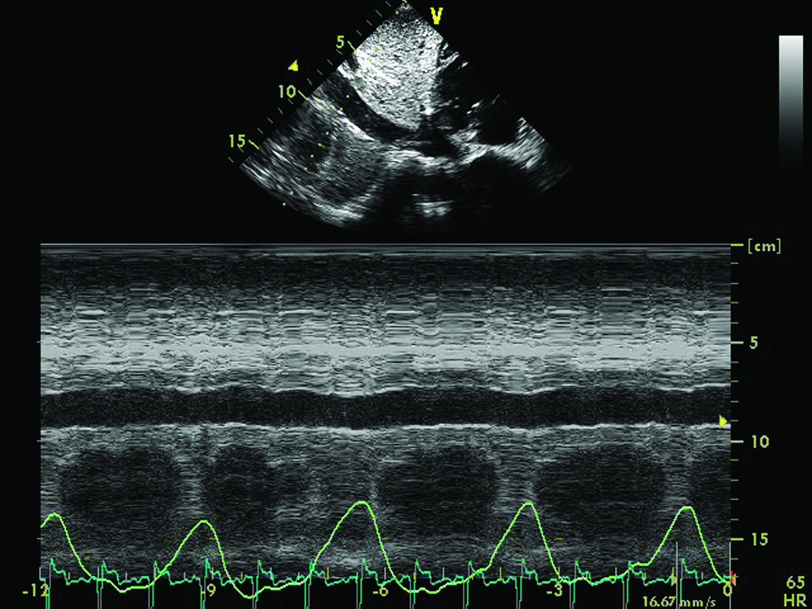 clinical application of ultrasound technques